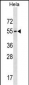 GALR3 Antibody (C-term)